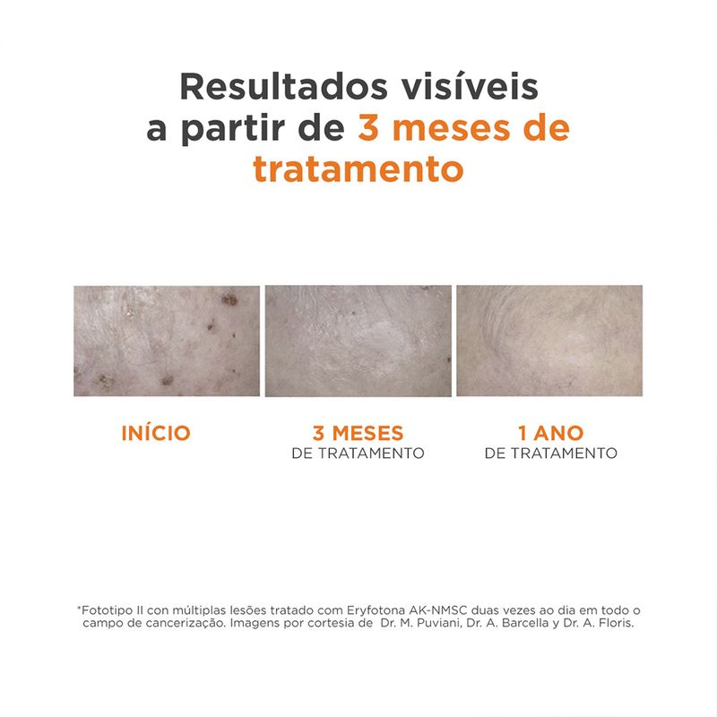 Protetor-Solar-Facial-Isdin-Eryfotona-AK-NMSC-FPS-99-50-ml
