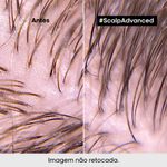 Mascara-de-Tratamento-2-em-1-L-Oreal-Professionnel-Serie-Expert-Scalp-Advanced-500-ml-Antes-e-Depois