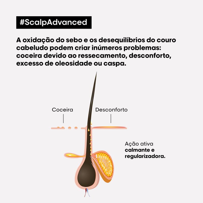 Tratamento-Calmante-Intensivo-L-Oreal-Professionnel-Serie-Expert-Scalp-Advanced-200-ml-Acao