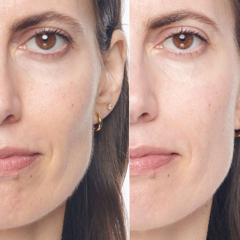 Serum-Facial-Anti-idade-Lancome-Renergie-H.C.F-Triple-50-ml-Modelo-e-Produto-1