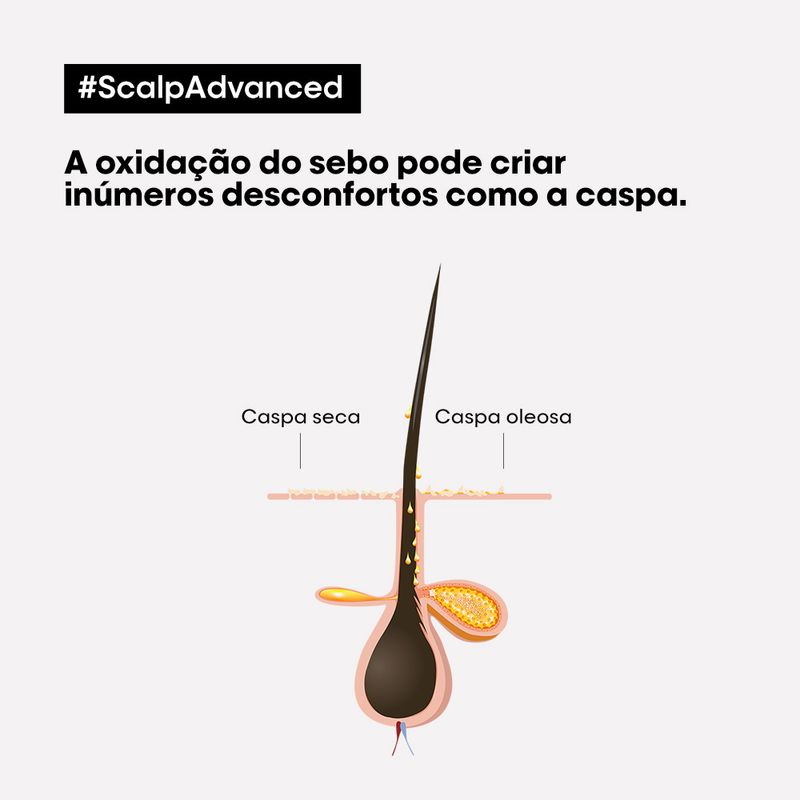 Shampoo-L-Oreal-Professionnel-Serie-Expert-Scalp-Advanced-Dermo-Clarifier-300-ml-Resultado