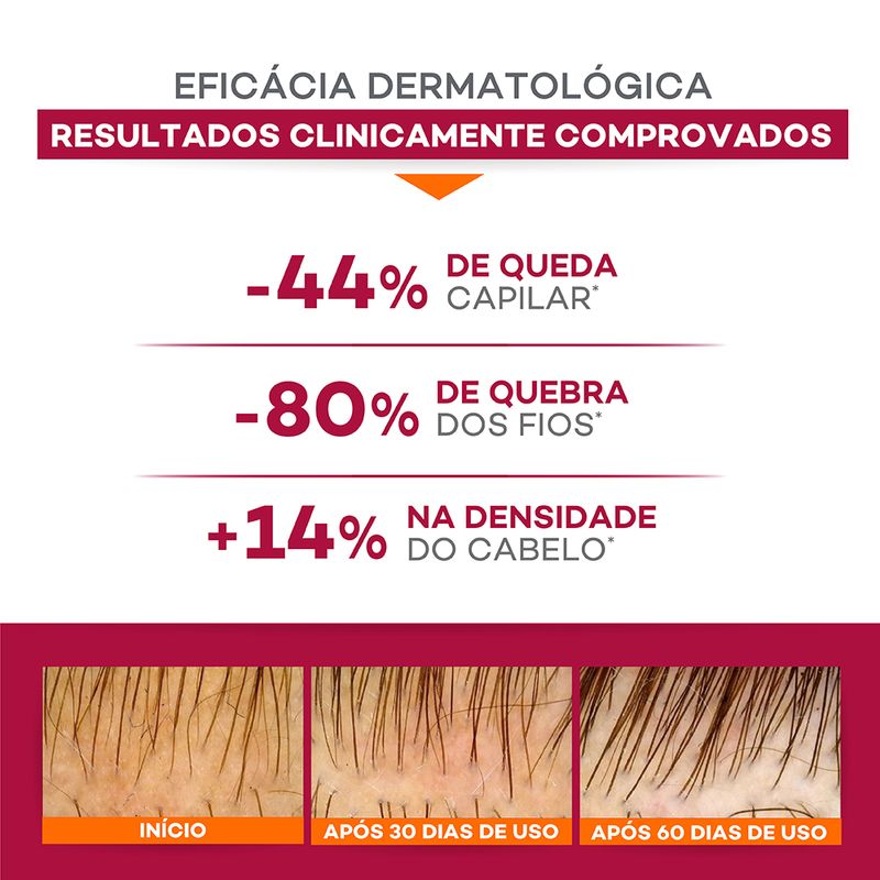 Shampoo-Antiqueda-Darrow-Doctar-Force-200-ml-Antes-e-Depois
