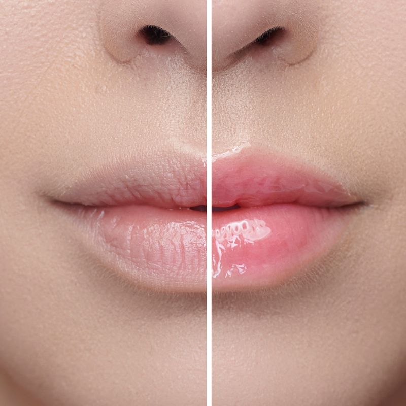 Gloss-Labial-Liquido-Oil-Restaurador-Karen-Bachini-Mercurio-62-g-Antes-e-Depois
