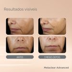 Serum-Facial-Clareador-de-Manchas-Isdin-Isdinceutics-Melaclear-Advanced-30-ml