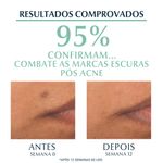 Serum-Facial-Tripla-Acao-com-Thiamidol-Eucerin-Dermo-Pure-Oil-Control-40-ml