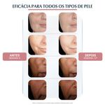 Serum-Facial-Clareador-Eucerin-Anti-Pigment-Dual-30-ml
