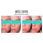 Gel-Creme-Facial-Creamy-Glicointense-Peel-30-g