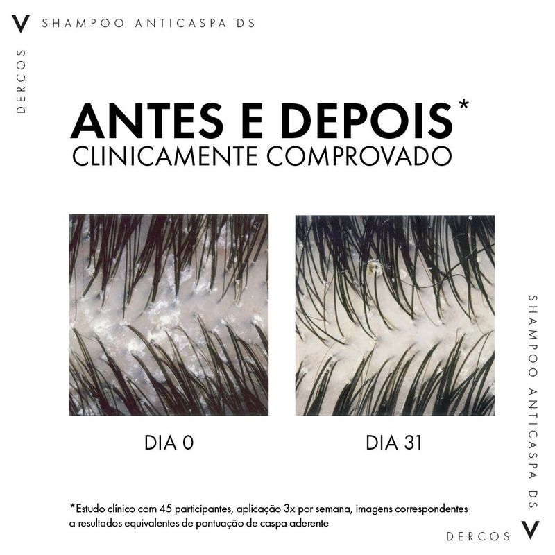 Shampoo-Vichy-Dercos-Anticaspa-Dry-300-ml