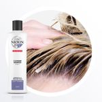 Shampoo-Nioxin-Sistema-5-300-ml