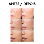 Serum-Antimanchas-Vichy-Liftactiv-Pigment-Specialist-B3-30-ml