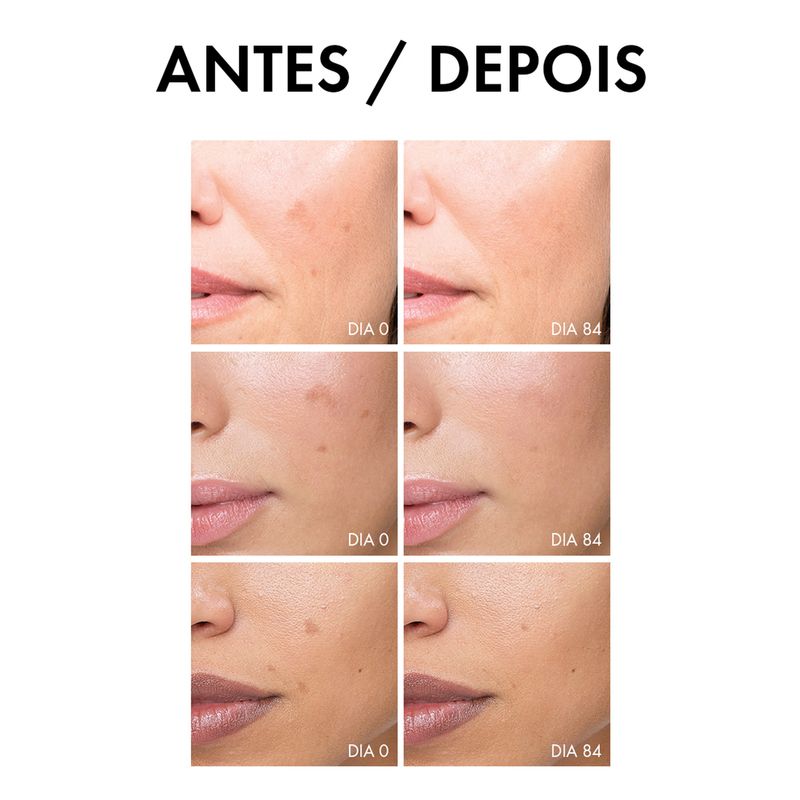 Serum-Antimanchas-Vichy-Liftactiv-Pigment-Specialist-B3-30-ml