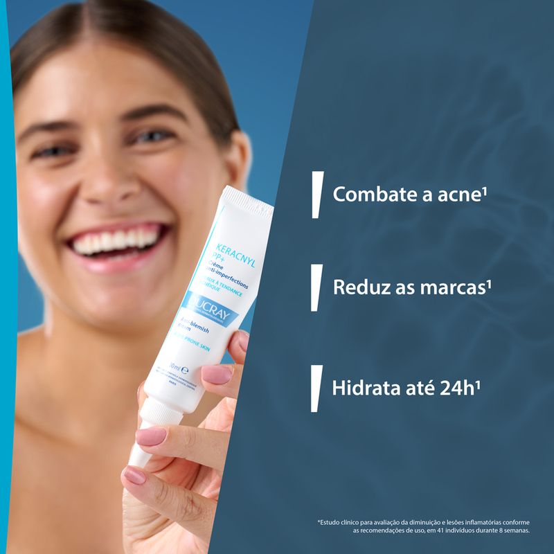 Creme-Antiacne-PP--Ducray-Keracnyl--30-ml