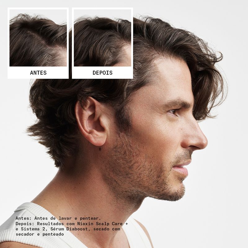 Kit-Sistema-2-de-Espessamento-para-Cabelo-Natural-com-Afinamento-Avancado---Kit-150-150-40ml-